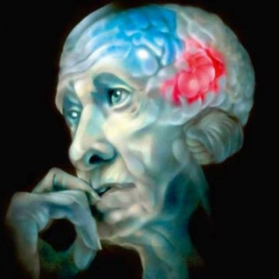 Болезнь Альцгеймера поможет предсказать виртуальная реальность